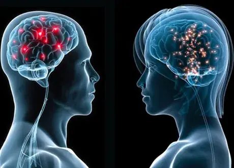 Graphic comparing the neural connections in male and female brains, with emphasis on the corpus callosum.