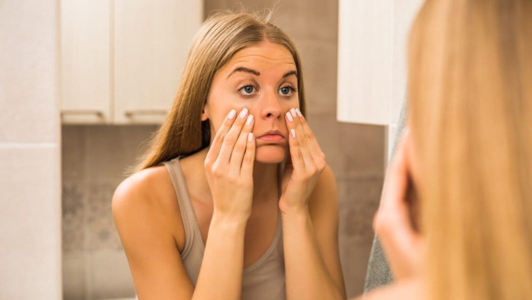 Mengatasi Mata Kering